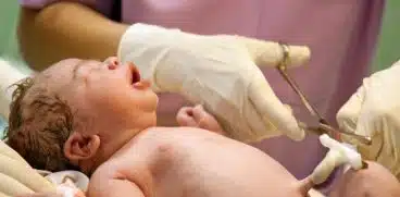 Beneficiile tăierii întârziate a cordonului ombilical. Recomandările OMS | Demamici.ro