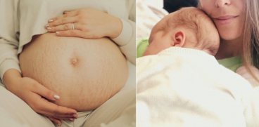 Marturia unei mame: „Mi-au aparut primele vergeturi la 31 de saptamani. Mi-a venit sa plang!” | Demamici.ro