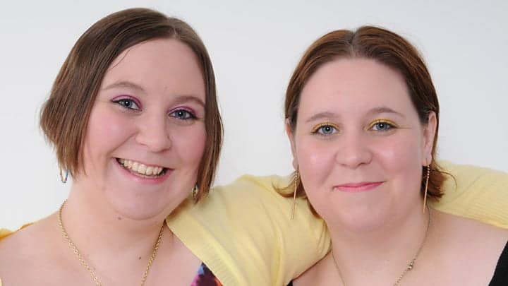Surori gemene identice au murit din cauza COVID-19. Lucrau ca asistente la secția de pediatrie