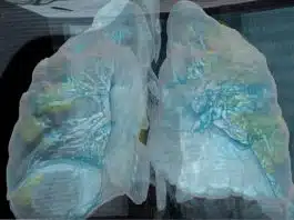 Cum arata plamanii unui pacient infectat cu COVID-19. Imagini 3D VIDEO | Demamici.ro