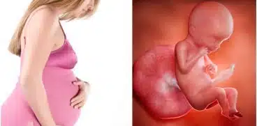 Durerea de ligament rotund in sarcina | Demamici.ro