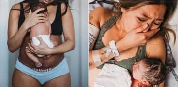 Cicatricea de la cezariană, semn al puterii, nu al slăbiciunii: „Fără ea nu mi-aș ține fetița la piept acum!” | Demamici.ro