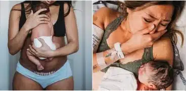 Cicatricea de la cezariană, semn al puterii, nu al slăbiciunii: „Fără ea nu mi-aș ține fetița la piept acum!” | Demamici.ro