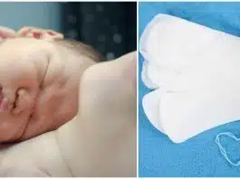 Eliminarea lohiilor. Când ai motiv de îngrijorare | Demamici.ro