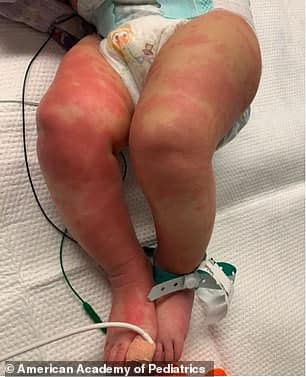 Bebeluș de 6 luni, diagnosticat cu boala Kawasaki și COVID-19. Legătura bizară descoperită de medici