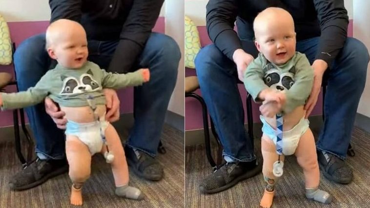 Un băiețel născut fără un picior dansează pentru prima dată, mulțumită unei proteze VIDEO | Demamici.ro