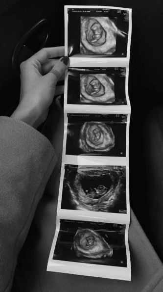 Alina Ceușan este însărcinată. Primele imagini cu burtica. Care este sexul copilului | Demamici.ro