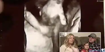 Un făt bolnav a fost surprins la ecograf în timp ce strângea mâna surorii gemene | Demamici.ro