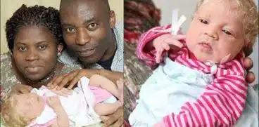 Un cuplu de africani a adus pe lume un bebeluș „alb ca zăpada” | Demamici.ro