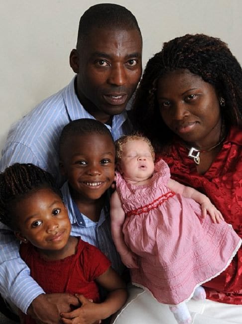 Un cuplu de africani a adus pe lume un bebeluș "alb ca zăpada"