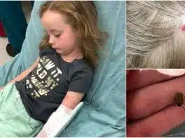 O fetiță  de 5 ani a paralizat temporar pe partea stângă și nu a mai putut vorbi 12 ore, după ce a fost mușcată de o căpușă | Demamici.ro
