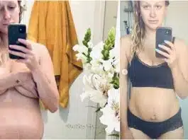 Bebelușul i-a murit în burtică. Confesiunea dureroasă a unei mame: „Corpul meu după ce-am pierdut o sarcină avansată!” | Demamici.ro