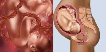 Sarcina pe saptamani: saptamana 35 de sarcina | Demamici.ro