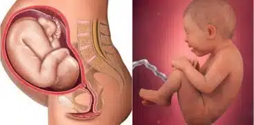 Sarcina pe saptamani: saptamana 36 de sarcina | Demamici.ro