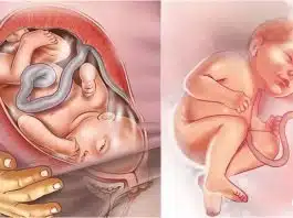 Sarcina pe saptamani: saptamana 39 de sarcina | Demamici.ro