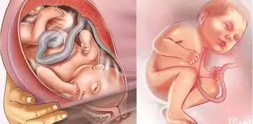 Sarcina pe saptamani: saptamana 39 de sarcina | Demamici.ro