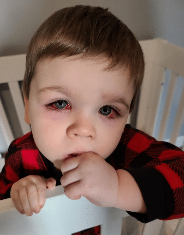 Pericolul ascuns din jucăriile pentru baie. Un băiețel a fost la un pas să-și piardă vederea din cauza lor | Demamici.ro