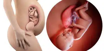 Sarcina pe saptamani: saptamana 38 de sarcina | Demamici.ro