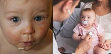 Alergiile alimentare la copii, mai periculoase decât intoleranțele. Care sunt principalele simptome | Demamici.ro