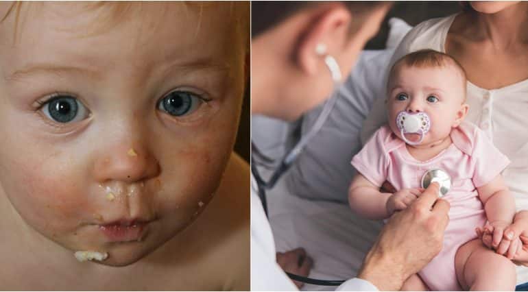 Alergiile alimentare la copii, mai periculoase decât intoleranțele. Care sunt principalele simptome | Demamici.ro