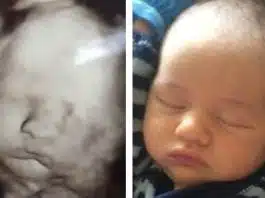 Pune ecografia din sarcină lângă bebelușul tău când doarme și vei avea o surpriză! Mămicile de pretutindeni au încercat acest experiment | Demamici.ro