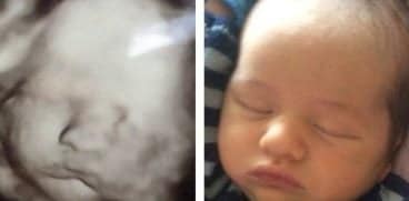 Pune ecografia din sarcină lângă bebelușul tău când doarme și vei avea o surpriză! Mămicile de pretutindeni au încercat acest experiment | Demamici.ro