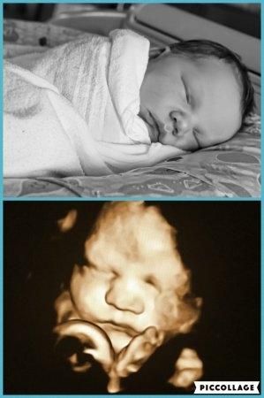 Așează ecografia din sarcină lângă bebelușul tău când doarme și vei avea o surpriză! Mămicile de pretutindeni au încercat acest experiment