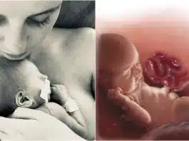 A aflat la naștere că băiețelul are intestinele în afara abdomenului și 10% șanse să trăiască! Poveste relatată de „mămica unui copil malformat” | Demamici.ro