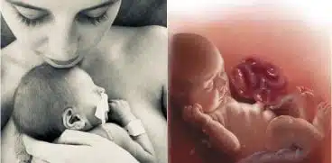 A aflat la naștere că băiețelul are intestinele în afara abdomenului și 10% șanse să trăiască! Poveste relatată de „mămica unui copil malformat” | Demamici.ro