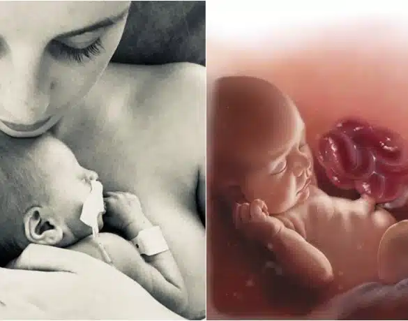 A aflat la naștere că băiețelul are intestinele în afara abdomenului și 10% șanse să trăiască! Poveste relatată de „mămica unui copil malformat” | Demamici.ro