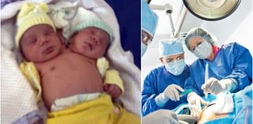 Bebeluși cu două capete. Cazurile medicale care au uluit lumea | Demamici.ro