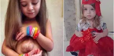 Fetița care s-a născut cu inima în afara pieptului a împlinit 11 ani. Medicii nu îi dădeau nicio șansă, dar ea a supraviețuit | Demamici.ro