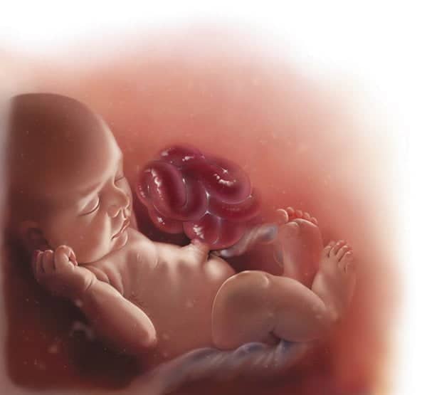 A aflat la naștere că băiețelul are intestinele în afara abdomenului și 10% șanse să trăiască! Poveste relatată de „mămica unui copil malformat” | Demamici.ro