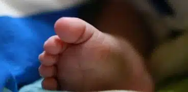 Bebeluș cu două capete, născut în România! Primele declarații ale reprezentaților Spitalului Universitar de Urgență Elias | Demamici.ro