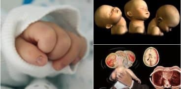 Sindromul copilului zgâlțâit. Anchetă în Botoșani după ce o fetiță de 6 luni a murit după ce-ar fi fost legănată prea tare | Demamici.ro