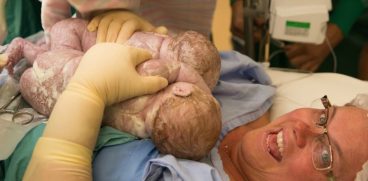 Momentul magic în care o mamă își scoate singură din pântece gemenii, în timpul nașterii prin cezariană | Demamici.ro