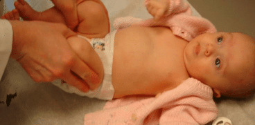 Ecografia de șold la bebeluși. Importanța ei în prevenirea și tratarea displaziei de șold | Demamici.ro