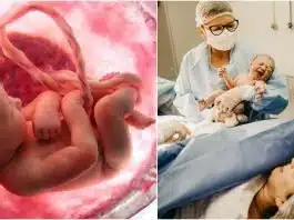 Celulele stem. De ce trebuie să recoltez celule stem la nașterea copilului. Informații complete despre recoltare, stocare, utilizare | Demamici.ro