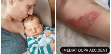 Tily Niculae, în alertă, după ce băiețelul ei de 1 an s-a opărit cu oala de pe aragaz: „arsură de gradul 2. Simțeam că-mi cedează inima” | Demamici.ro