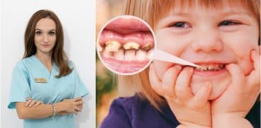 Demineralizarea dinților. Din ce cauză apare, cum o recunoaștem și cum se tratează? Interviu cu Dr. Sfedu Anamaria Virginia – medic pedodont | Demamici.ro