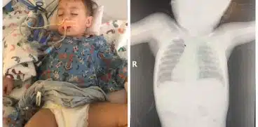 Obiectele mici din casă, un pericol uriaș: „Copilul meu era să moară înecat cu o baterie cât un nasture!” | Demamici.ro