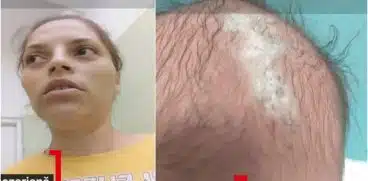 Fetiță nou-născută, tăiată pe cap în timpul nașterii prin cezariană, în Drobeta Turnu Severin VIDEO | Demamici.ro
