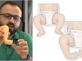 Picioarele strâmbe la naștere? Malformația „Picior varus equin”, explicată de un specialist în Ortopedie Pediatrică VIDEO | Demamici.ro