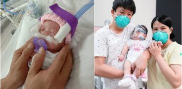 Cel mai mic bebeluș din lume s-a născut cu greutatea unui măr. Fetița a fost externată după 13 luni de spitalizare | Demamici.ro