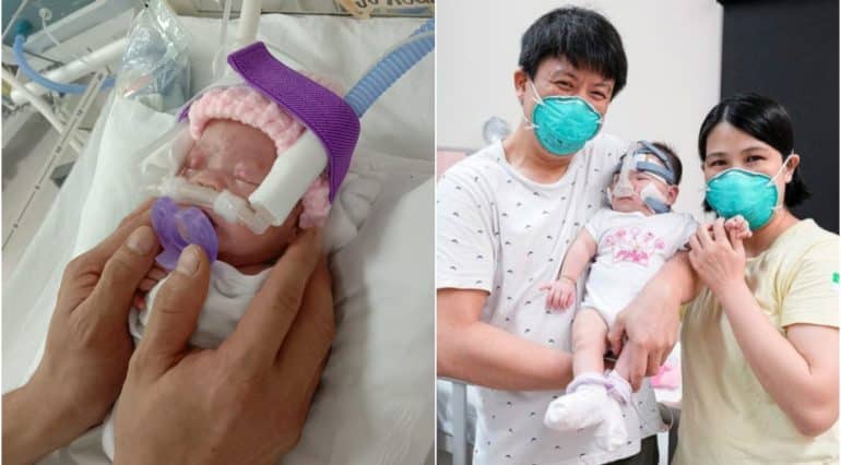 Cel mai mic bebeluș din lume s-a născut cu greutatea unui măr. Fetița a fost externată după 13 luni de spitalizare | Demamici.ro