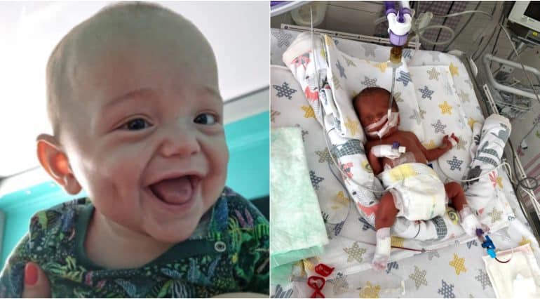 David, al doilea nou-născut prematur salvat datorită celulelor stem, în Spitalul Regina Maria Băneasa, a împlinit primul an de viață. Drumul către vindecare | Demamici.ro