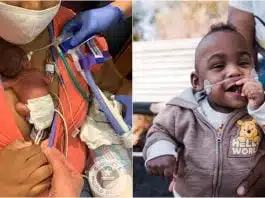 Cel mai mic bebeluș prematur a intrat în Cartea Recordurilor. A venit pe lume la 21 săptămâni de sarcină. Cum arată băiețelul în prezent | Demamici.ro