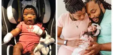 O fetiță s-a născut cu o afecțiune rară de piele și le-a dat „oamenilor mari” o importantă lecție de viață | Demamici.ro