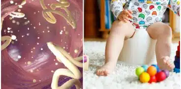 Infecția parazitară cu oxiuri la copii. Ce trebuie să știi despre oxiuroză sau oxiuriază | Demamici.ro