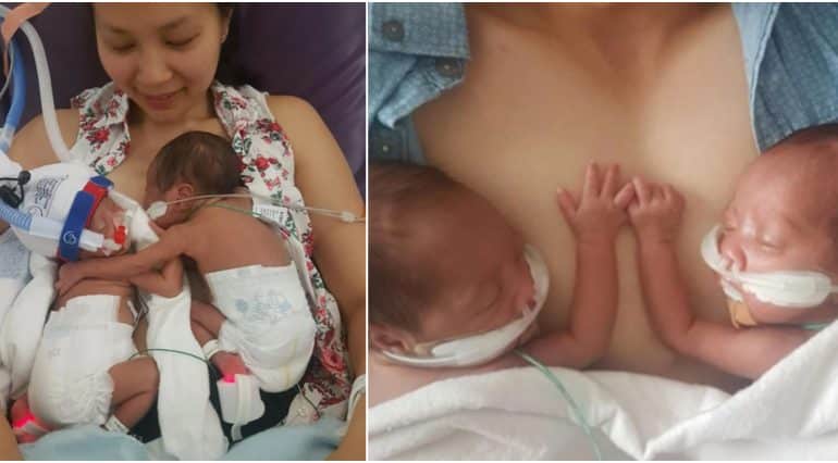 Fetițe gemene, născute prematur, se îmbrățișează la prima întâlnire după ieșirea din burtică | Demamici.ro